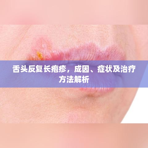 舌头反复长疱疹，成因、症状及治疗方法解析