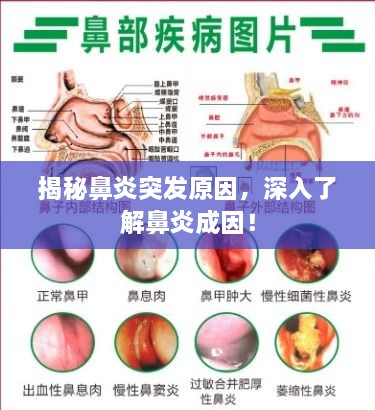揭秘鼻炎突发原因，深入了解鼻炎成因！