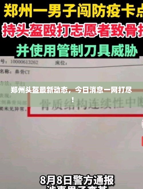 郑州头盔最新动态，今日消息一网打尽！